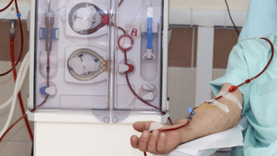 What to Expect When Undergoing Dialysis Treatment